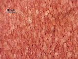 3 - Cellule corticali in visione superficiale